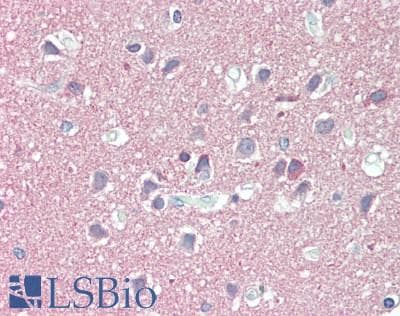 IHC-plus™ RTN3 / Reticulon 3 Antibody (aa550-600)