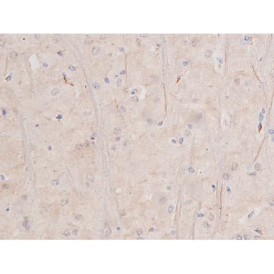 c-Kit / CD117 Antibody (phospho-Tyr703)