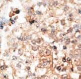 Osteocalcin Antibody (aa2-32)