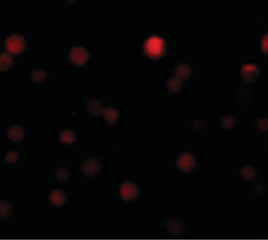 ZEB1 / AREB6 Antibody