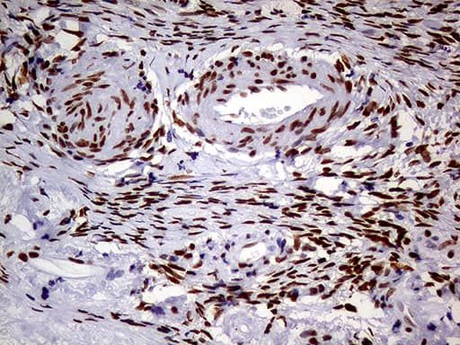 MEIS1 Antibody (aa176-390, clone OTI2A3)