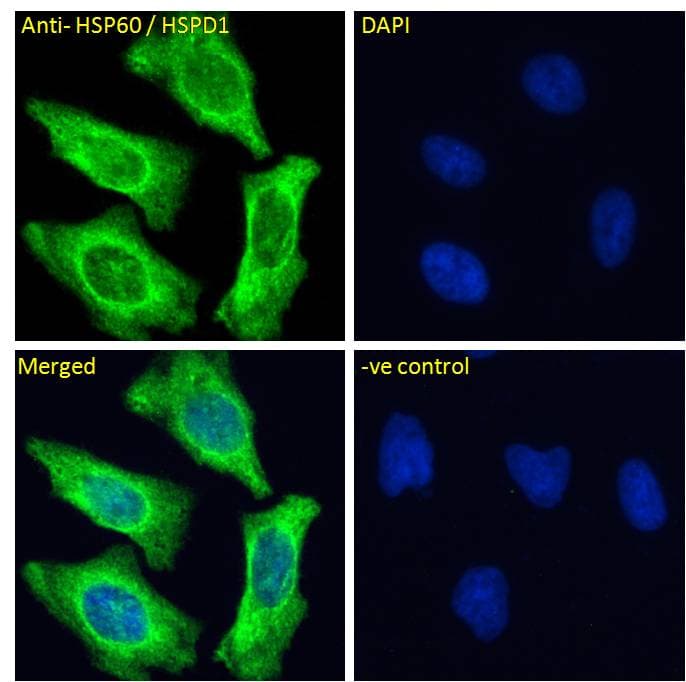 PathPlus™ HSPD1 / HSP60 Antibody