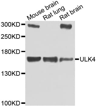 ULK4 Antibody