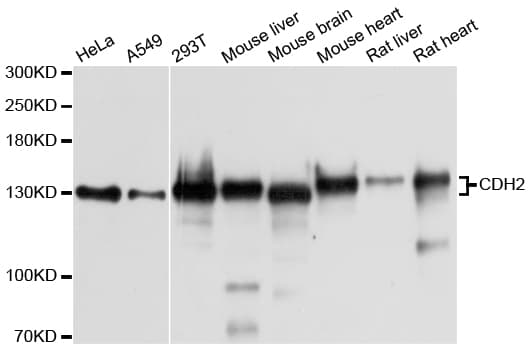 IHC-plus™ CDH2 / N Cadherin Antibody