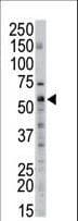 Polyclonal Rabbit anti-Human SPTLC2 / LCB2 Antibody (aa531-562, WB)