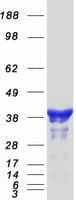 Human NUDEL / NDEL1 Protein (Recombinant Myc-DDK (Flag))