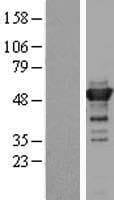 TLDC1 / KIAA1609 Protein (Over-Expression Lysate Myc-DDK (Flag))