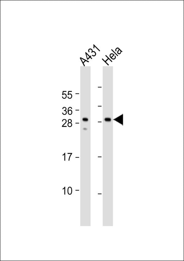 NFYB Antibody