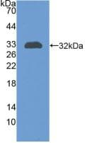 CR1 / CD35 Antibody (aa1780-2039, PE)