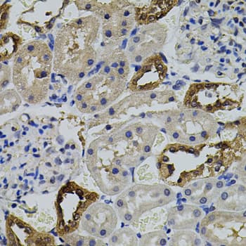 Polyclonal Rabbit anti-Human AURKC / Aurora C Antibody (IHC, WB)