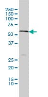 Monoclonal Mouse anti-Human SLC18A1 / VMAT1 Antibody (clone 3A2-E10, WB)