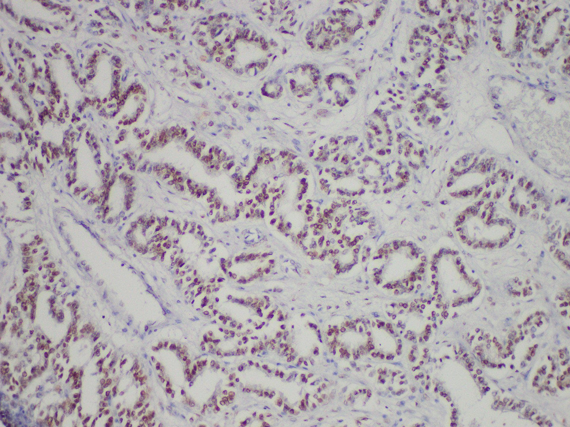 AR / Androgen Receptor Antibody