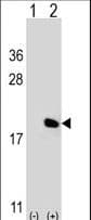 IL17A Antibody (aa61-87)