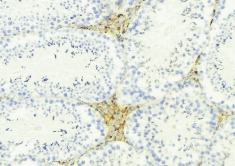 APOL4 / Apolipoprotein L 4 Antibody