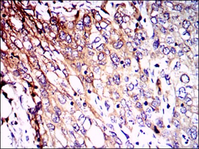 Monoclonal Mouse anti-Human NF-L / NEFL Antibody (clone 1H3, IHC, IF, WB)