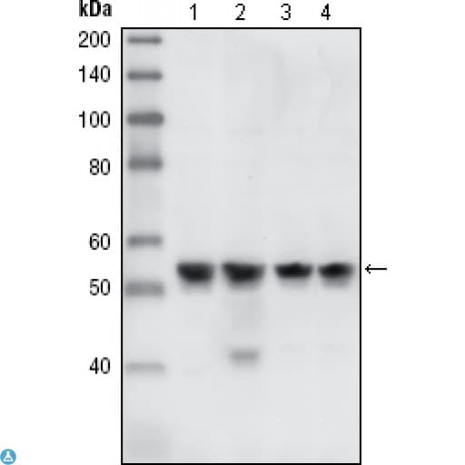 CHEK1 / CHK1 Antibody