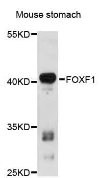 Polyclonal Rabbit anti-Human FOXF1 Antibody (WB)
