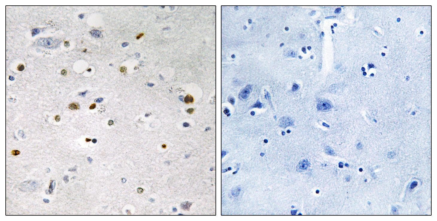 ZNF7 Antibody