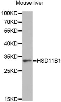 Polyclonal Rabbit anti-Human HSD11B1 / HSD11B Antibody (IHC, WB)