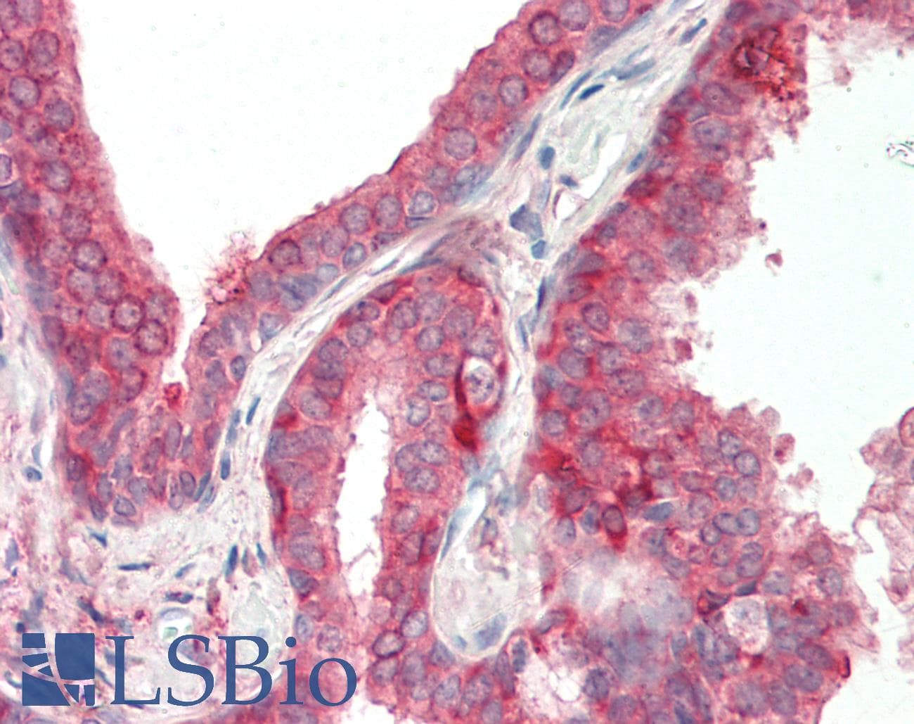 ADAMTS4 Antibody (aa101-150)