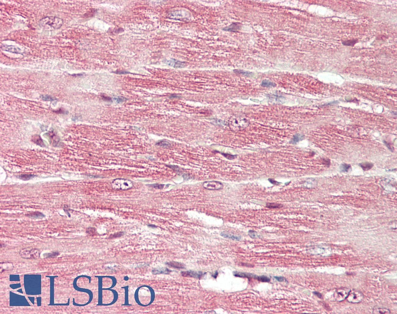 PathPlus™ BDNF Antibody