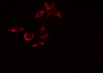Polyclonal Rabbit anti-Human PAK1 Antibody (IHC, IF, WB)