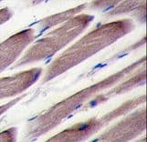 LATS2 Antibody (aa228-258)