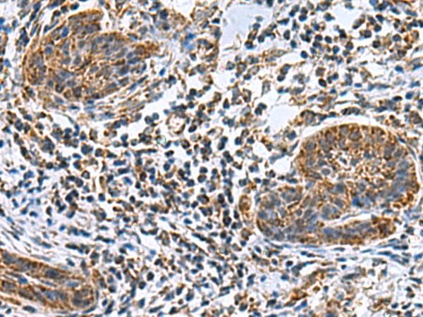 MRPL40 Antibody