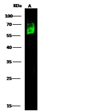 Polyclonal Rabbit anti-Human CD46 Antibody (Preservative Free, IHC, WB)