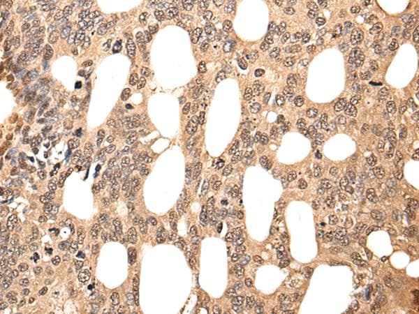 ATF7 Antibody