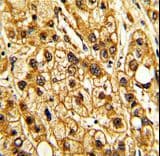 Polyclonal Rabbit anti-Human ITGAX / CD11c Antibody (aa1119-1145, IHC, IF, WB)