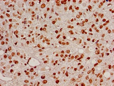 HIST1H2BB Antibody