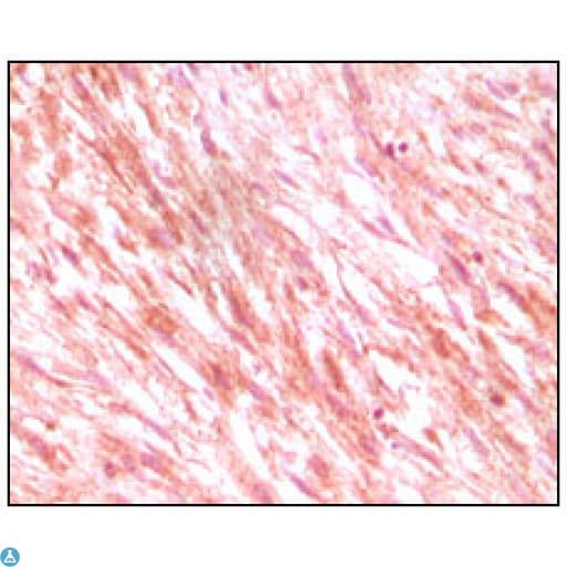 c-Kit / CD117 Antibody