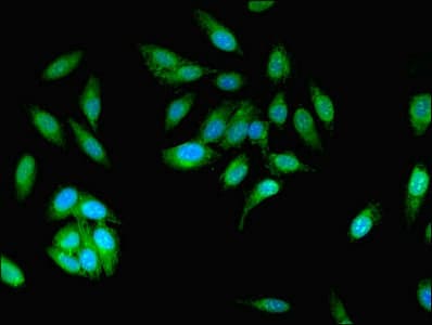 Polyclonal Rabbit anti-Human MCPH1 Antibody (aa536-835, IHC)