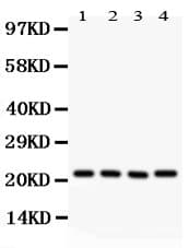 ATP5H Antibody (aa2-161)