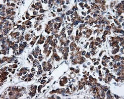 KIAA0153 / TTLL12 Antibody (clone OTI5H3)
