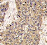 Polyclonal Rabbit anti-Human CASP6 / Caspase 6 Antibody (aa235-263, IHC, WB)