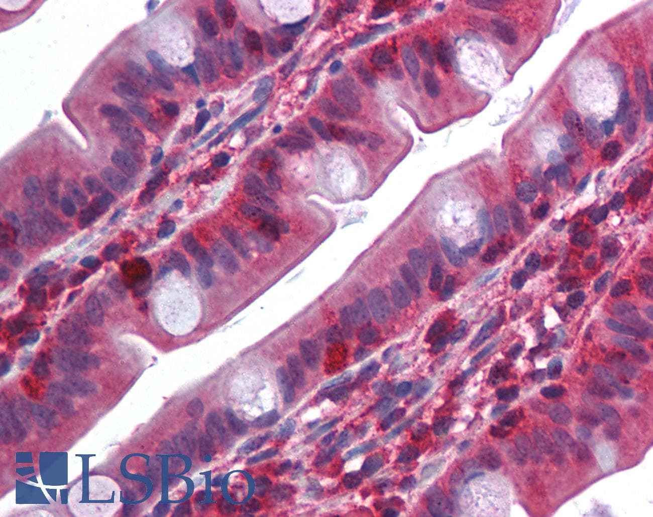 PathPlus™ Polyclonal Rabbit anti-Human TRAF2 Antibody (IHC, IF, WB)