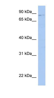 NRROS / LRRC33 Antibody (aa359-408)