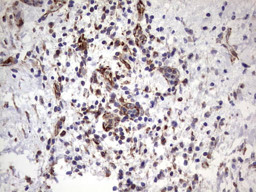 PPP2R5D Antibody (clone OTI3B3)
