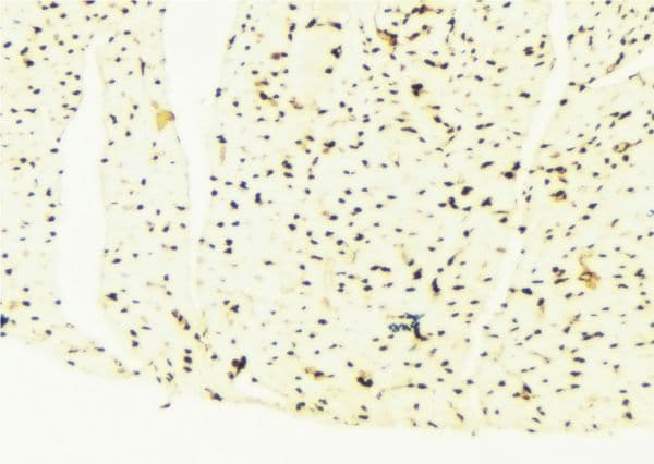CDKN1B / p27 Kip1 Antibody