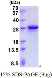 Human MRPL28 Protein (Recombinant His)