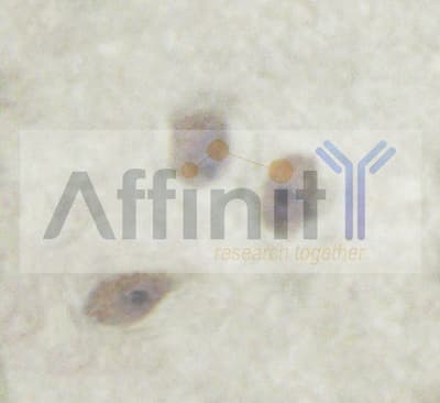 Polyclonal Rabbit anti-Human PTP1B Antibody (IHC, IF, WB)