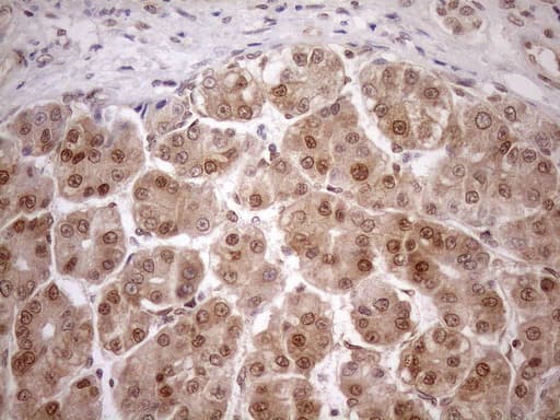 MGMT Antibody (clone OTI5A7)