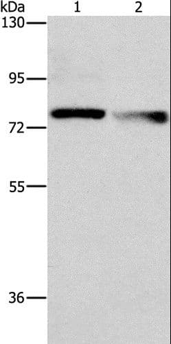 Polyclonal Rabbit anti-Human NEK11 Antibody (WB)