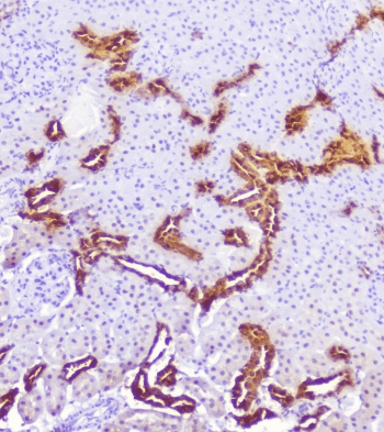 CALB1 / Calbindin Antibody
