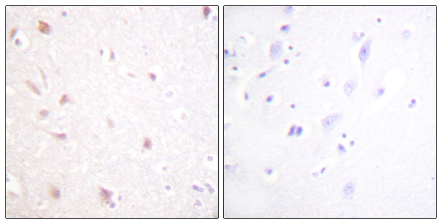 Polyclonal Rabbit anti-Human NIFK / MKI67IP Antibody (aa200-249, IHC, IF)