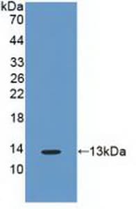 CDK2 Antibody (aa94-198, APC)