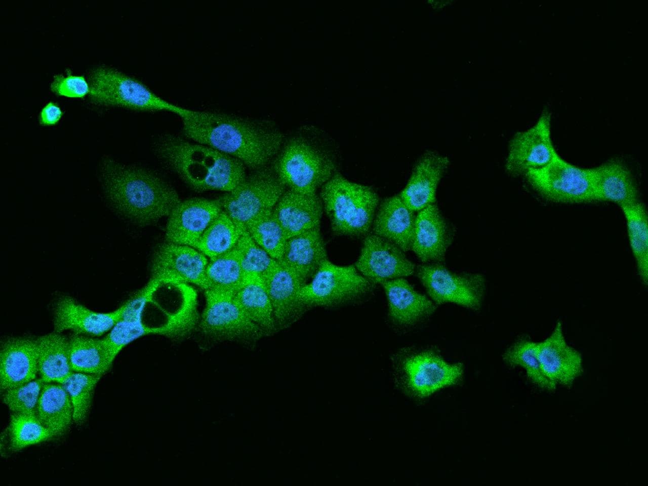 OAS2 Antibody