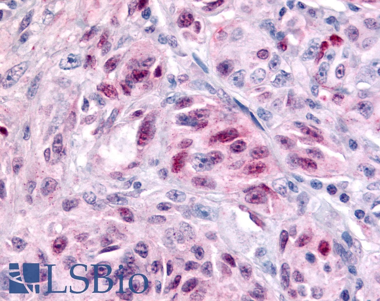 IHC-plus™ Polyclonal Rabbit anti-Human NR1D2 Antibody (Ligand-binding Domain, IHC)